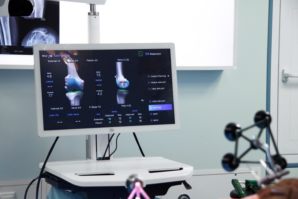 Робот-хирург в операционной: впервые в НМИЦ травматологии и ортопедии ...