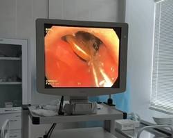 21.01 %d0%92%d1%80%d0%b0%d1%87%d0%b8 %d1%85%d0%b8%d1%80%d1%83%d1%80%d0%b3%d0%b8 %d1%81. %d0%9a%d0%b0%d0%b7%d0%b0%d0%bd%d1%81%d0%ba%d0%be%d0%b5 %d0%b8%d0%b7%d0%b2%d0%bb%d0%b5%d0%ba%d0%bb%d0%b8 %d1%83 %d1%80%d0%b5%d0%b1%d0%b5%d0%bd%d0%ba%d0%b0 10 %d1%80%d1%83%d0%b1%d0%bb%d0%b5%d0%b9   %281%29