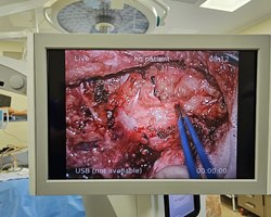 %d0%be%d0%bf%d0%b5%d1%80%d0%b0%d1%86%d0%b8%d1%8f 3