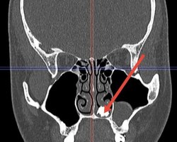 Photo 2025 03 04 12 25 47