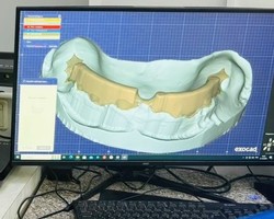 %d0%a4%d0%be%d1%82%d0%be 3. %d0%9c%d0%be%d0%b4%d0%b5%d0%bb%d1%8c %d0%b2%d0%b5%d1%80%d1%85%d0%bd%d0%b5%d0%b9  %d1%87%d0%b5%d0%bb%d1%8e%d1%81%d1%82%d0%b8 