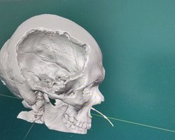 %d0%ba%d1%80%d0%b0%d0%bd%d0%b8%d0%be%d0%bf%d0%bb%d0%b0%d1%81%d1%82%d0%b8%d0%ba%d0%b0 1