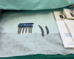 %d0%be%d0%bf%d0%b5%d1%80%d0%b0%d1%86%d0%b8%d1%8f %d0%bd%d0%b0 %d0%bf%d0%be%d0%b7%d0%b2%d0%be%d0%bd%d0%be%d1%87%d0%bd%d0%b8%d0%ba%d0%b5 2