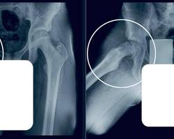 Photo 2025 11 21 11 21 27