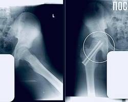 Photo 2025 11 21 11 21 28