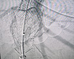 Photo 5260310498165591697 y