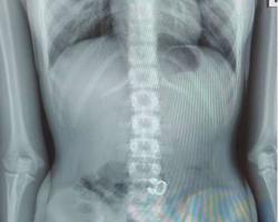 Photo 2025 11 25 12 20 33