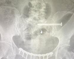 Photo 2025 11 27 11 52 46