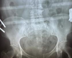 Photo 2025 11 27 11 52 45